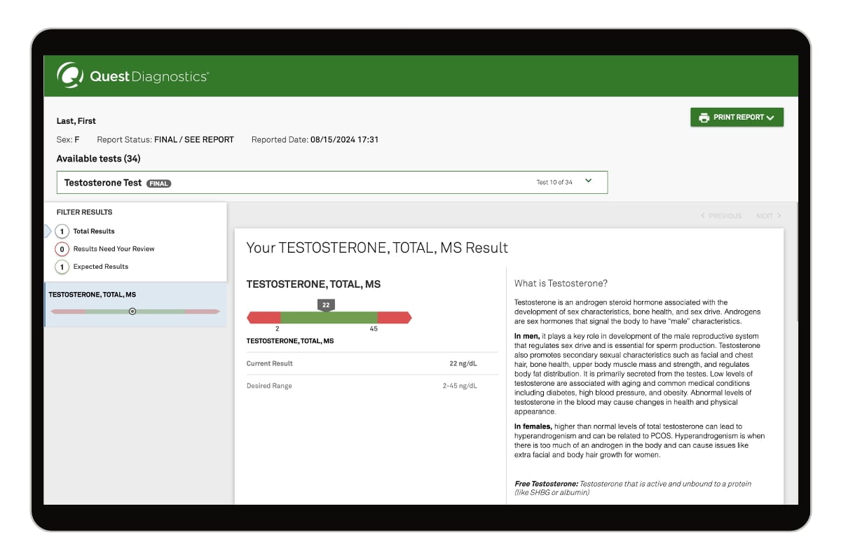 Testosterone Test image number 0